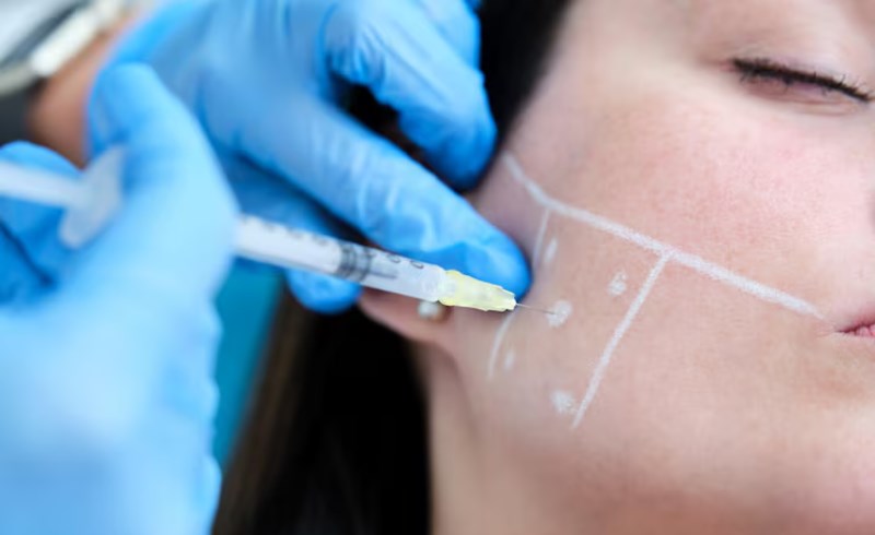 성형 수술 날짜 택일 시 추가 고려사항