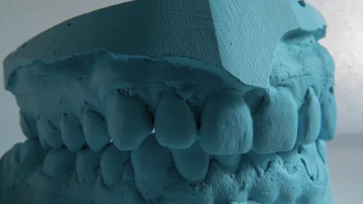 사주 금(金), 치아 건강이 약해지기 쉬운 금다자 사주를 위한 소금 가글 개운법과 체질 개선 전략 3